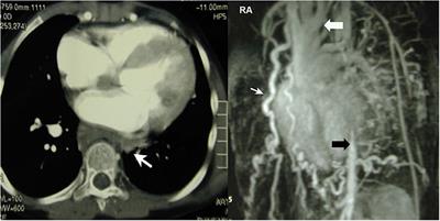 A case series of rare pathologies of the aorta and the aortic arch in adolescents and younger adults: Transfer of experience for an individualized approach